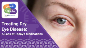 Clinical Capsules Treating Dry Eye Disease: A Look at Today’s Medications