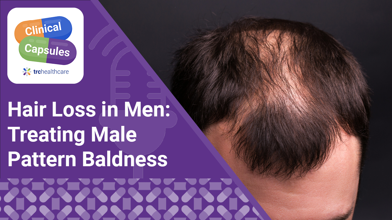 Clinical Capsules Hair Loss in Men: Treating Male Pattern Baldness